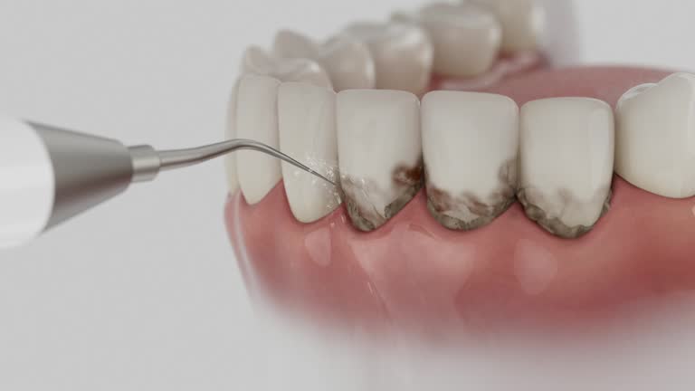 Trusted Wisdom Tooth Removal service in Pottstown, PA - Dentist Open Now